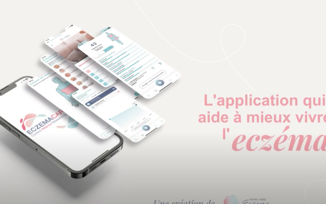 Eczema CARE+ : l’application qui aide à mieux vivre l’eczéma