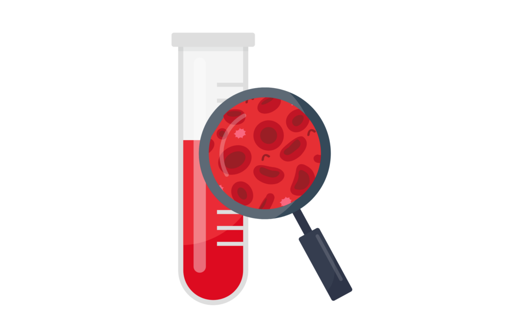 Des chercheurs de Leuven mettent au point un test sanguin innovant pour le dépistage du cancer