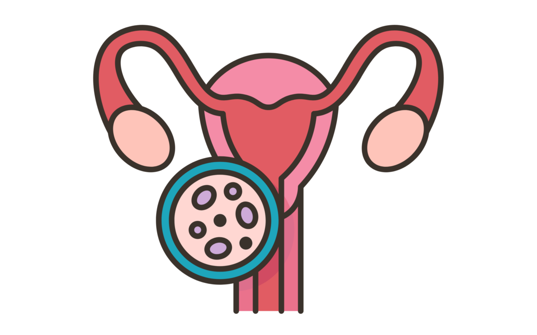 Un traitement probiotique prometteur contre la récidive de la vaginose bactérienne